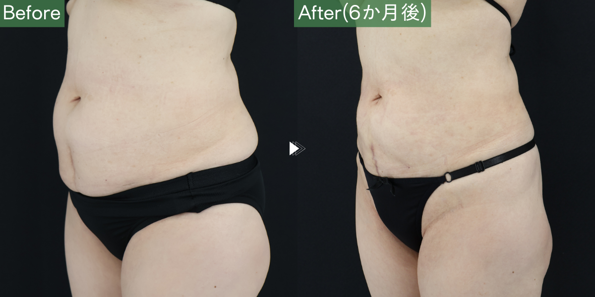 No.7009の症例写真