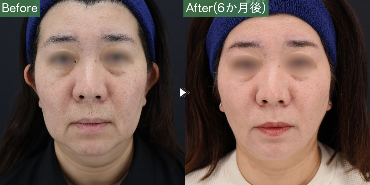 No.6686の症例写真