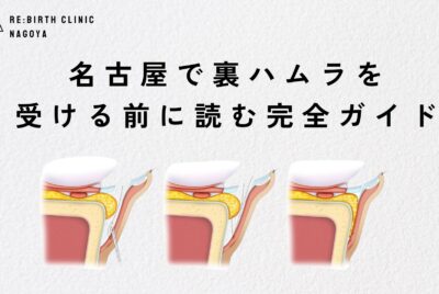 名古屋で裏ハムラを受ける前に読む完全ガイド