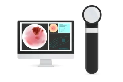 ダーモスコピーとは？検査の全知識と流れ