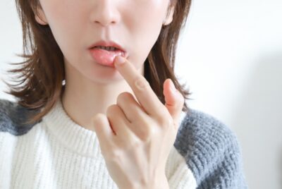 【皮膚科医解説】病院で処方されるヘルペス内服薬の種類と違い