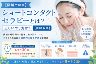 【図解で解説】ショートコンタクトセラピーとは?正しいやり方は?【医師監修】