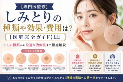 【専門医監修】しみとりの種類や効果・費用は?【図解完全ガイド】