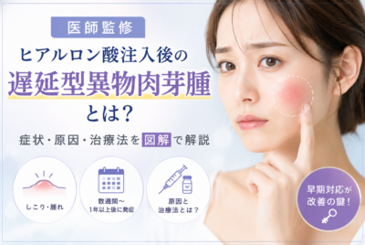 ヒアルロン酸注入後の遅延型異物肉芽腫とは?症状と治療法を図解【医師監修】