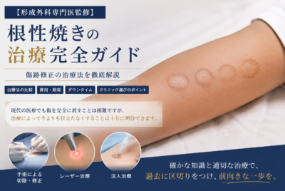 【形成外科専門医監修】根性焼きの治療完全ガイド【傷跡修正】