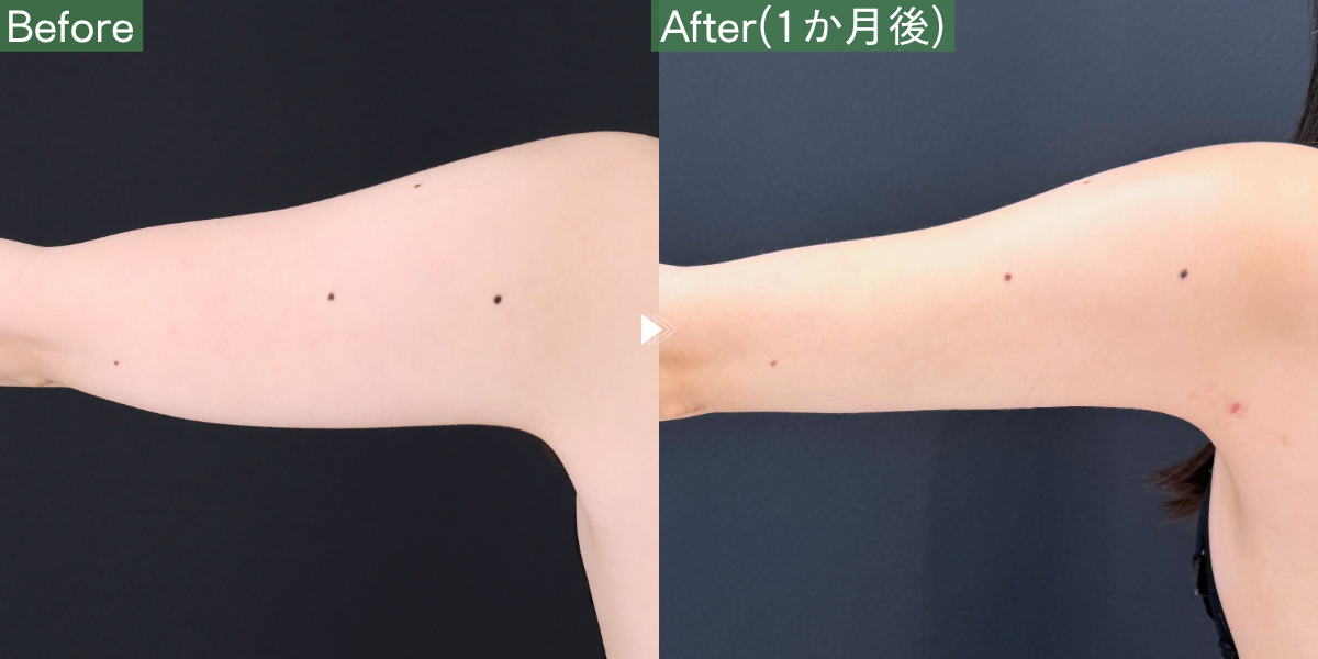 No.9930の症例写真