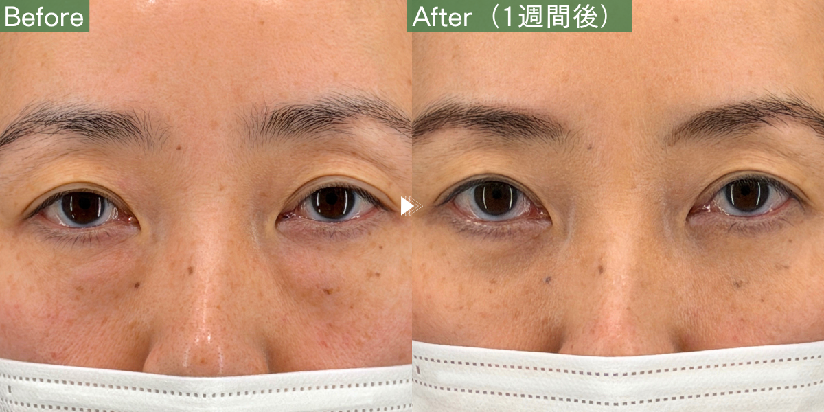 No.10110の症例写真 No.10110の症例写真