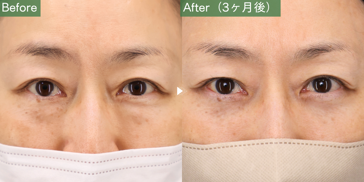 No.10298の症例写真
