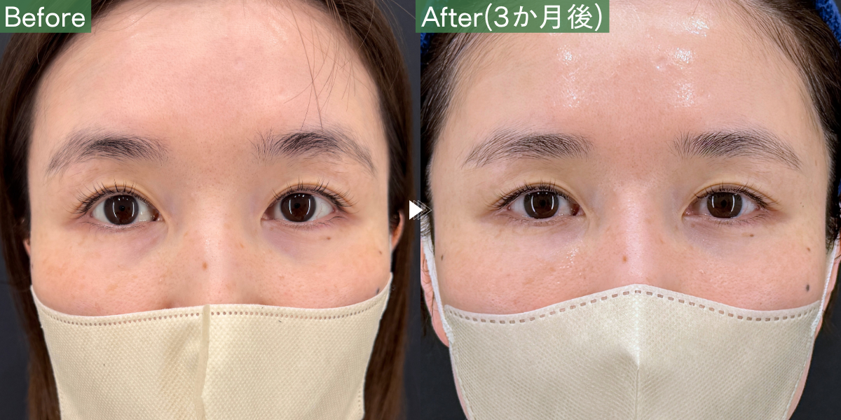 No.10039の症例写真
