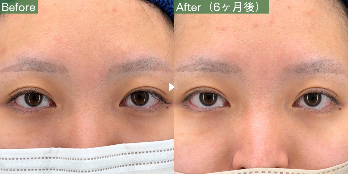 No.10187の症例写真 No.10187の症例写真