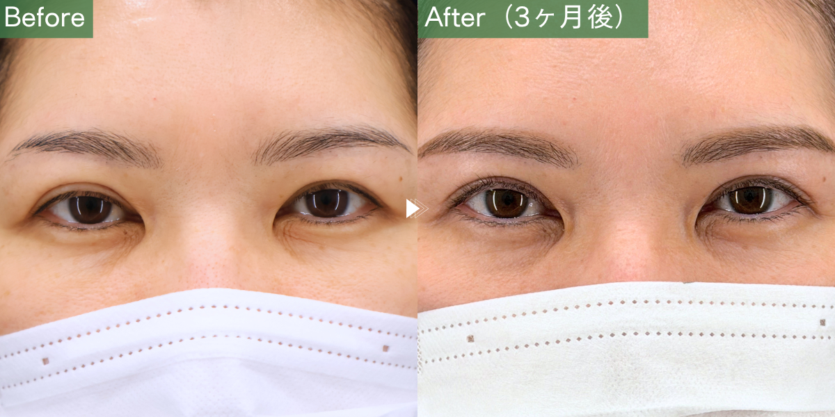 No.10339の症例写真