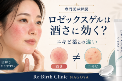 【図解で分かりやすい】酒さに効く?ロゼックスゲルとニキビ薬の違いを専門医が解説!