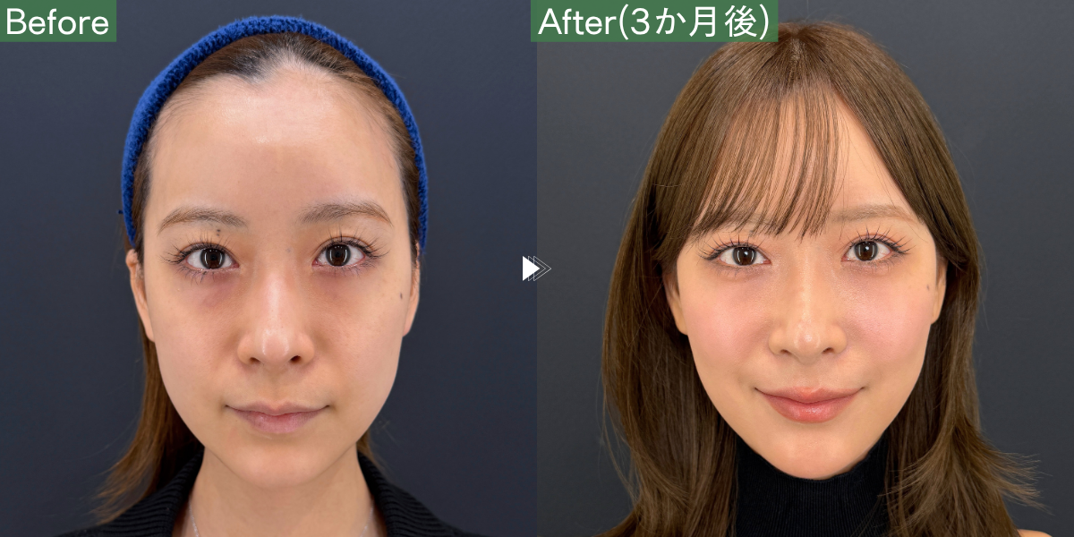 No.11307の症例写真 No.11307の症例写真