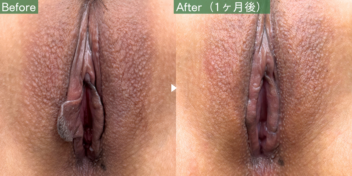 No.11163の症例写真