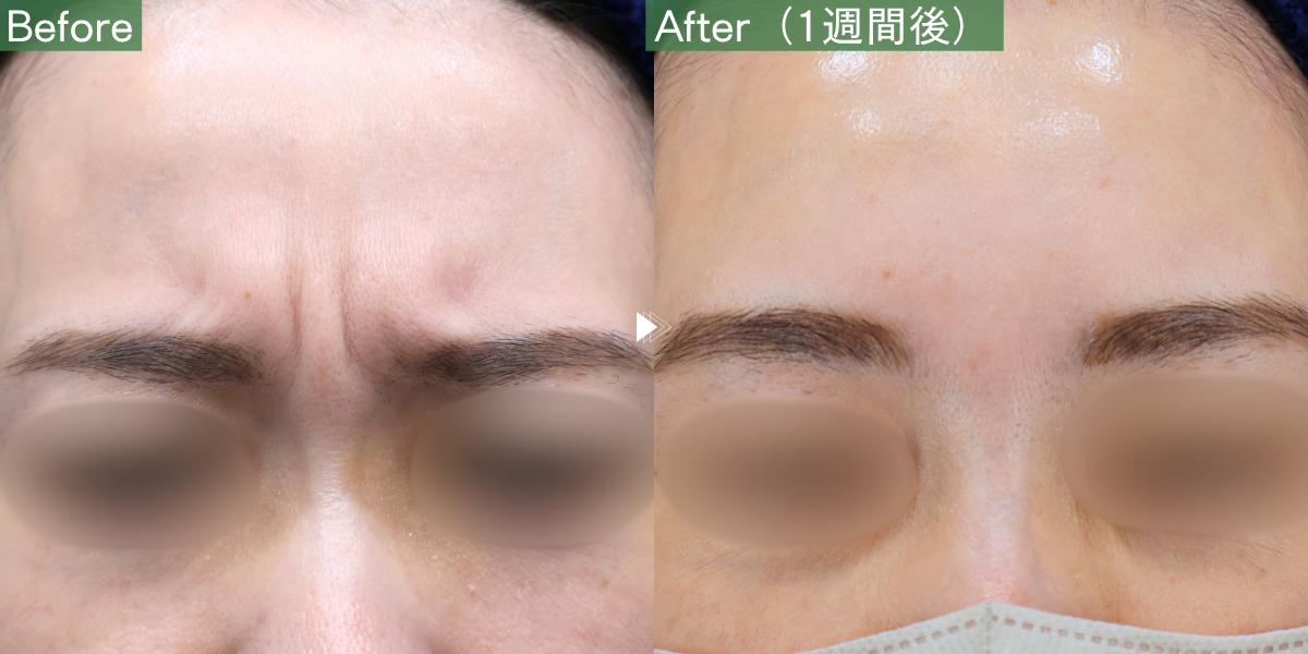 No.10811の症例写真