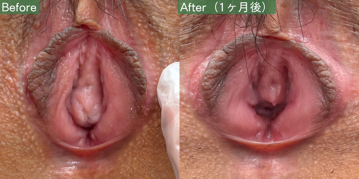 No.11392の症例写真