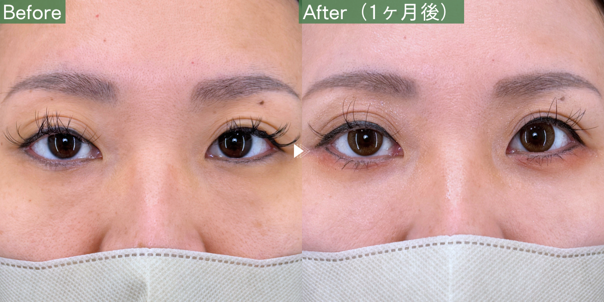 No.11241の症例写真 No.11241の症例写真