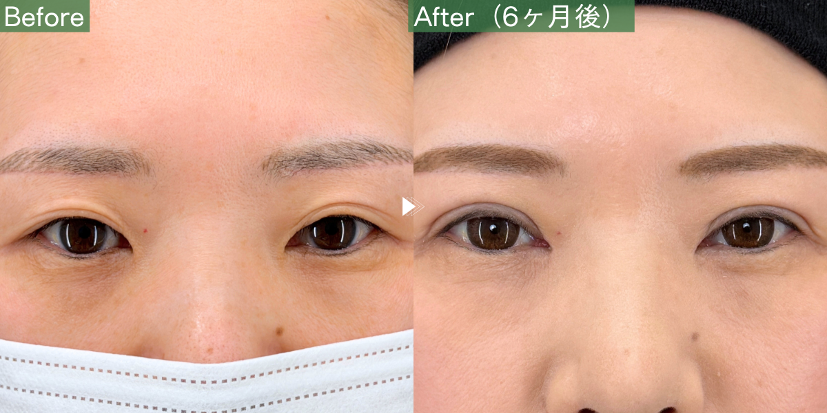 No.11414の症例写真