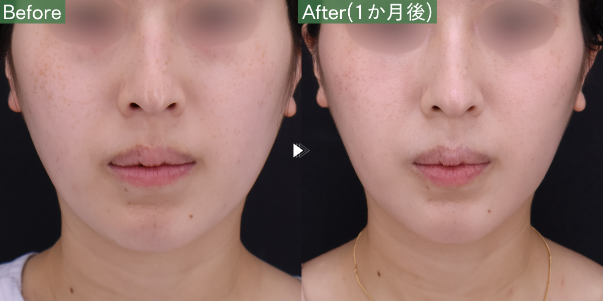 No.11095の症例写真 No.11095の症例写真