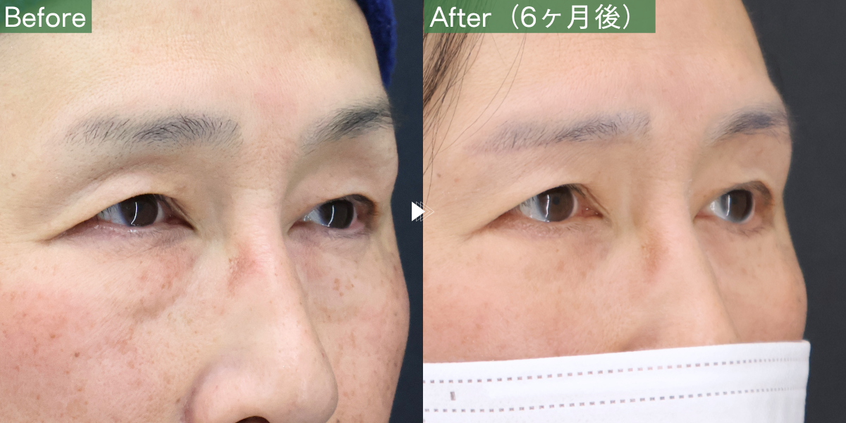 No.11352の症例写真
