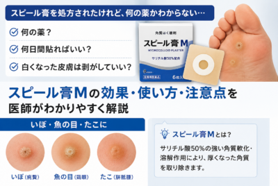 スピール膏とは？いぼ・魚の目への効果、使い方・何日貼るかを医師が解説