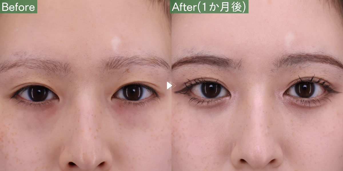 No.11089の症例写真