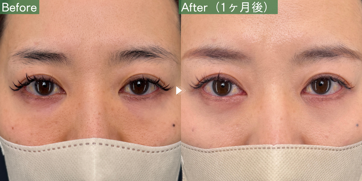 No.11012の症例写真 No.11012の症例写真