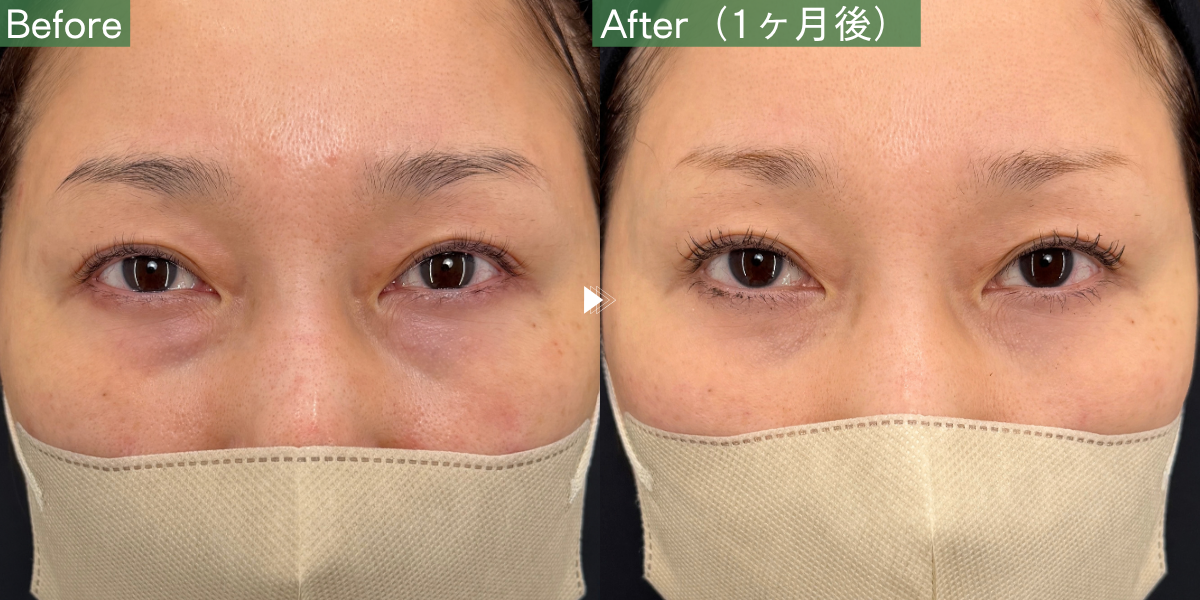 No.12642の症例写真