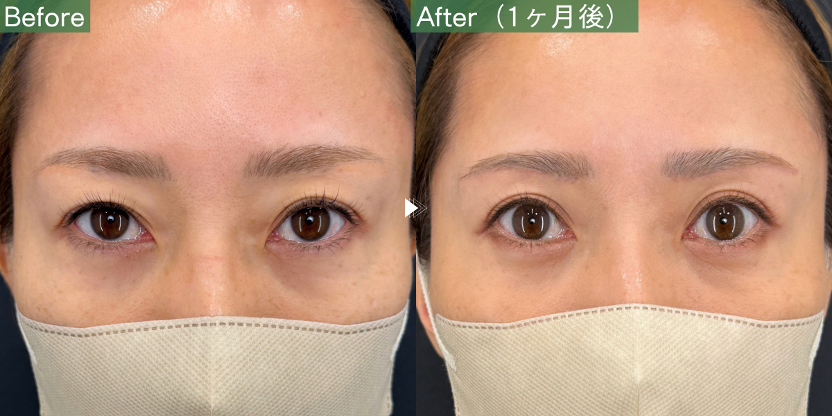 No.12515の症例写真