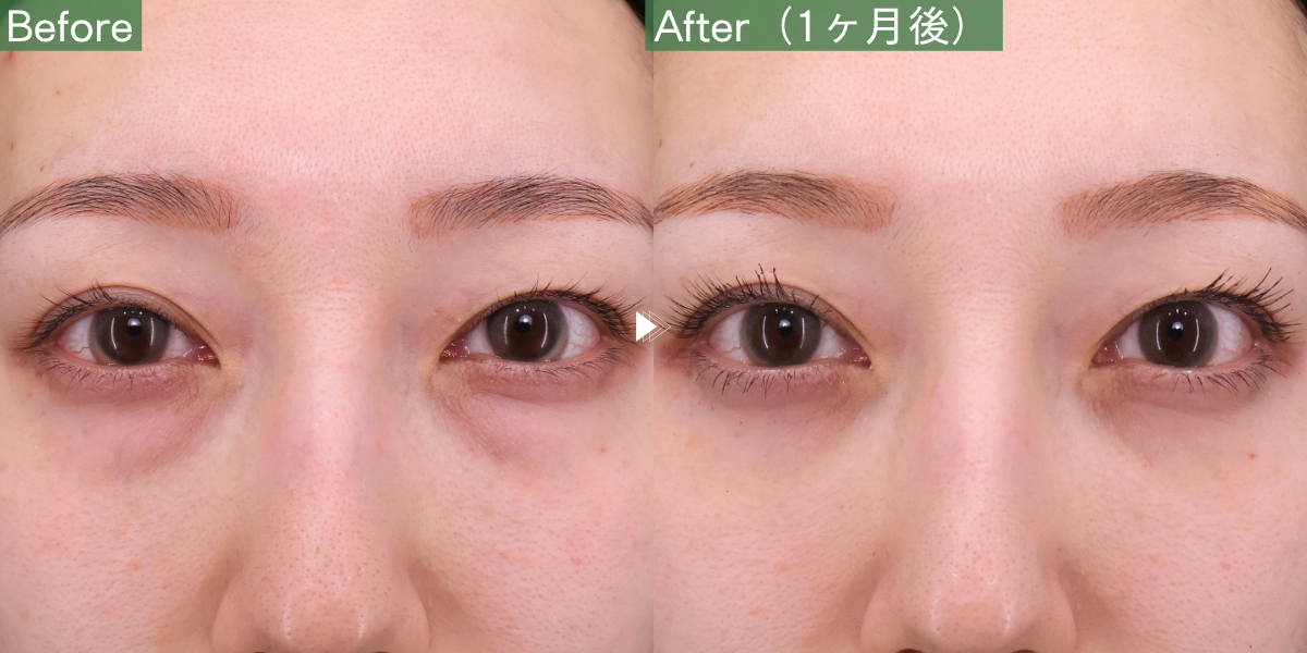 No.11882の症例写真