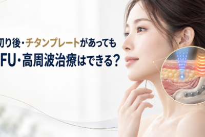 骨切り後・チタンプレートが入っていても HIFUや高周波治療は受けられる?