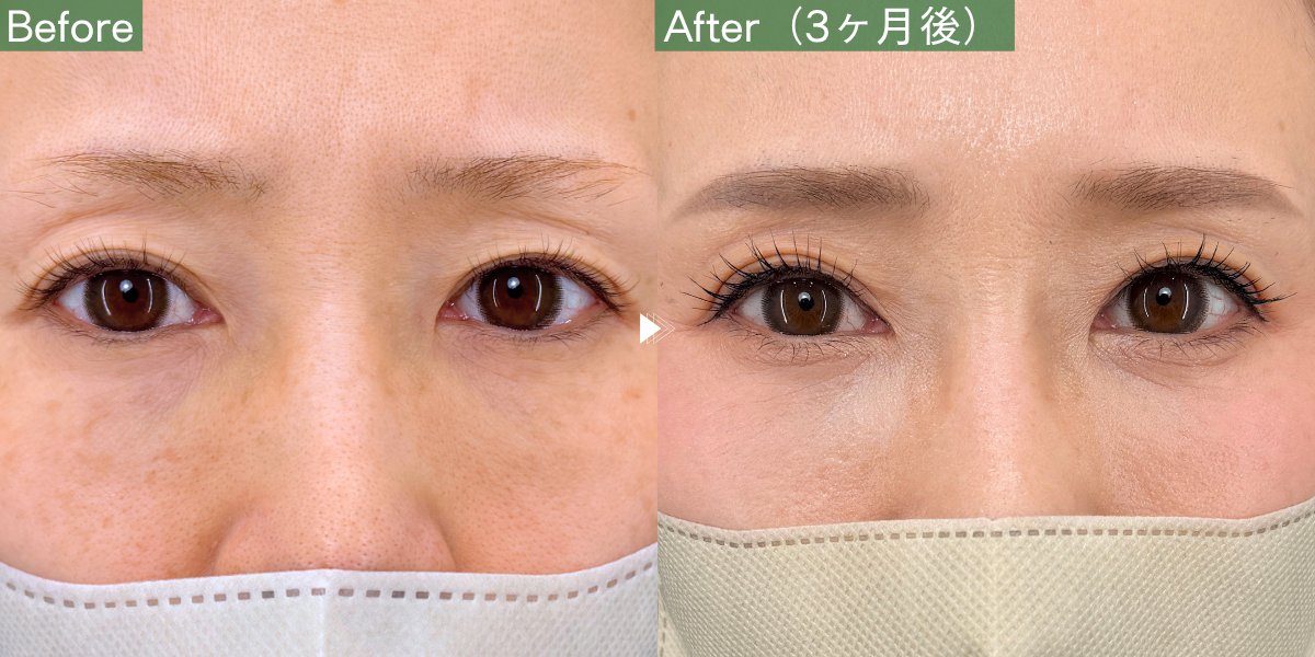 No.12229の症例写真