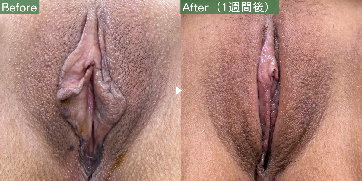No.12171の症例写真