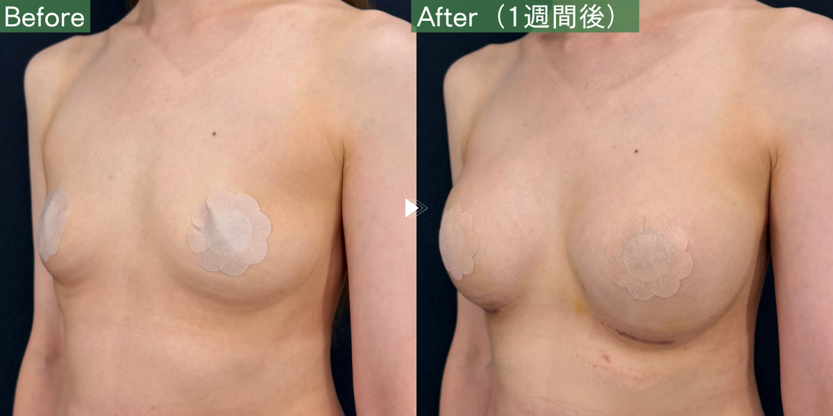 No.13181の症例写真 No.13181の症例写真