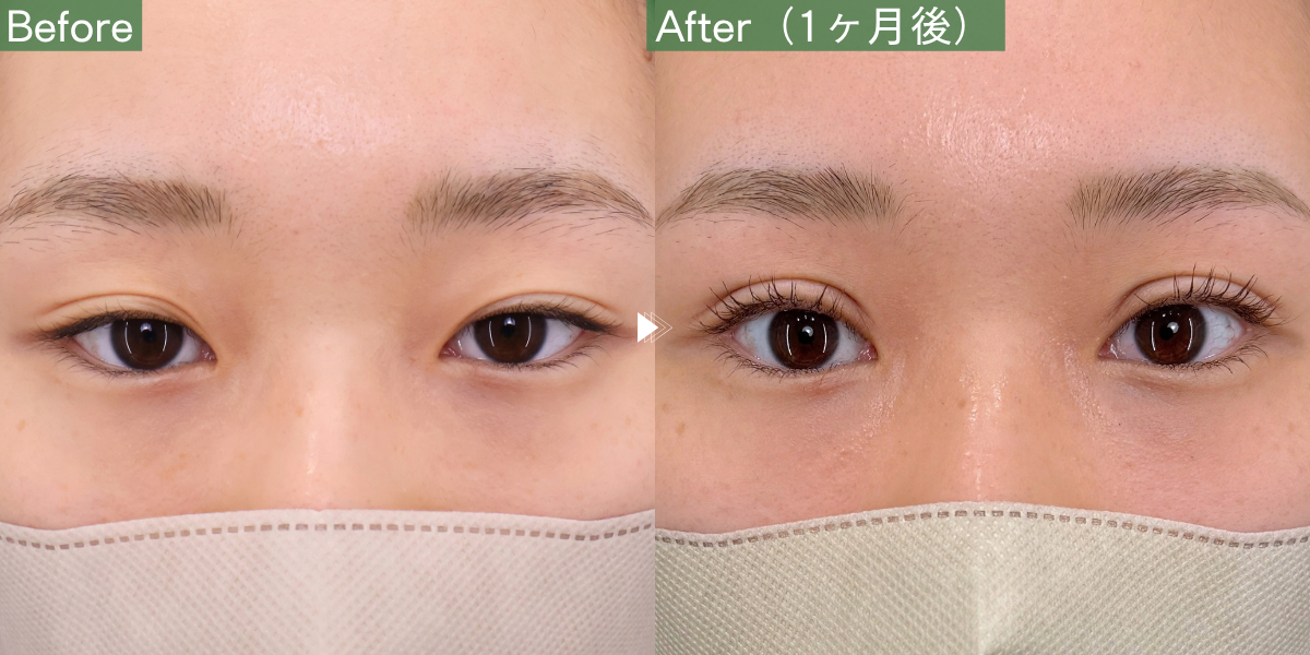 No.12679の症例写真