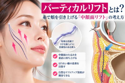 バーティカルリフトとは？ 糸で頬を引き上げる「中顔面リフト」の考え方