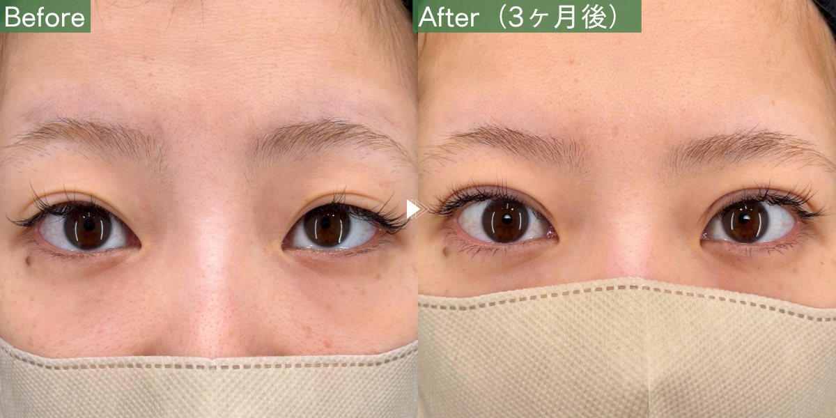 No.12716の症例写真