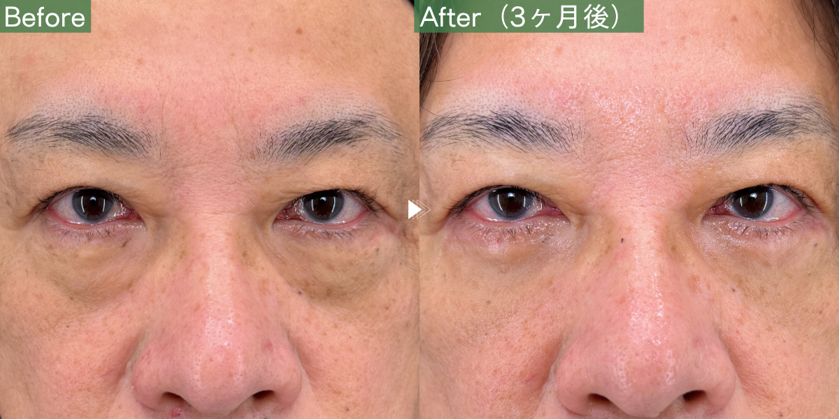 No.12856の症例写真